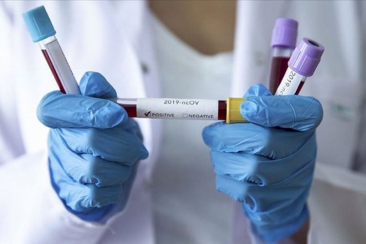 Dünya genelinde vaka sayısı 31 milyonu aştı