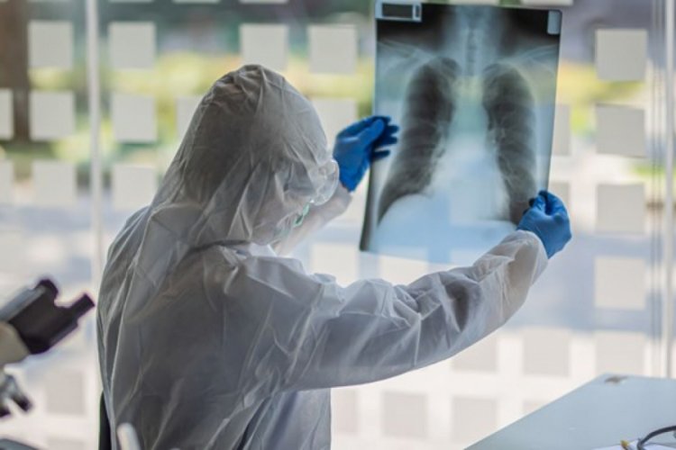 Koronavirüsü yenen doktor uyardı: Hastalık ansızın yakalıyor ve hemen de bırakmıyor