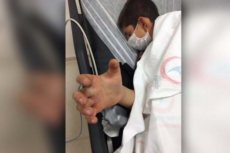 Arkadaşlarıyla oynarken yılanın ısırdığı 13 yaşındaki Civan, yoğun bakımda