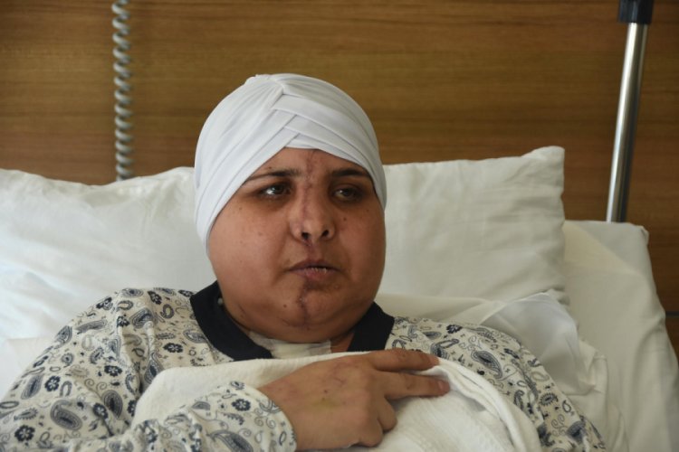 Bursalı kadının yüzü kazada ikiye ayrıldı