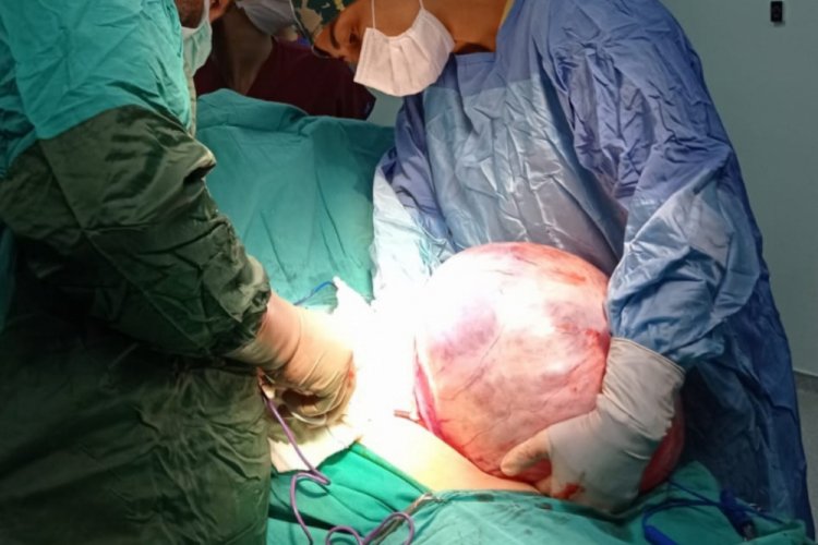 Karnından 5.5 kilo ağırlığında tümör çıktı