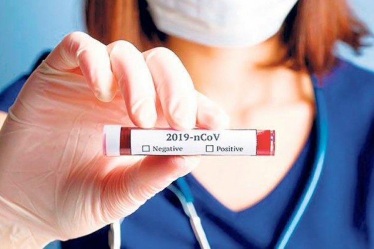 Dünya genelinde koronavirüs tespit edilen kişi sayısı 35 milyon 400 bini aştı