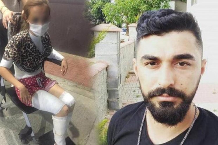 Kızgın bıçakla eşinin vücudunu dağlayan cani koca yakalandı