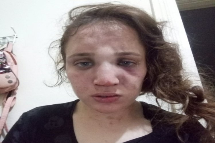 3 çocuk annesi kadını bu hale kocası getirdi