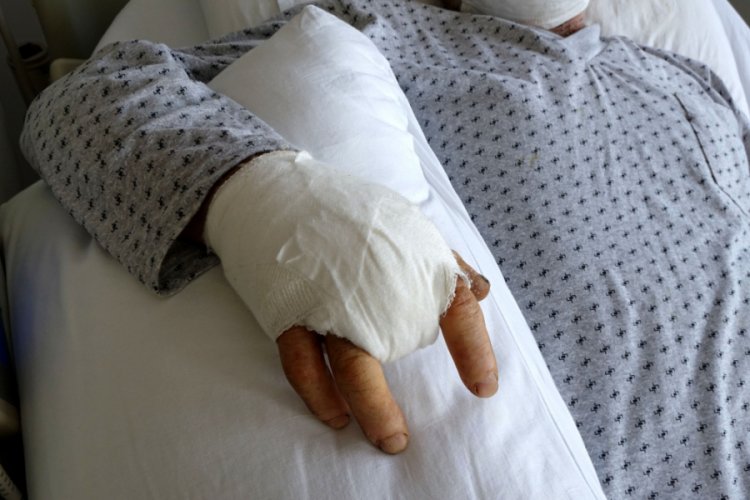 Kangren olan parmağı kesildi, 'ihmal' iddiasına soruşturma açıldı