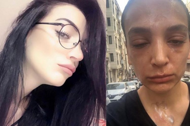 Lavabo açıcı bomba gibi patlamıştı! 1.5 milyon TL'lik tazminat davası