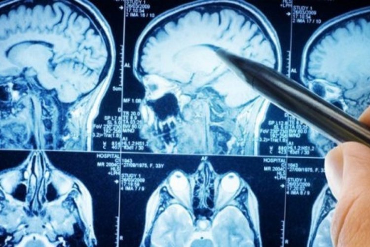 Bilim insanları, kafatasında yeni bir organ bulduklarını açıkladı
