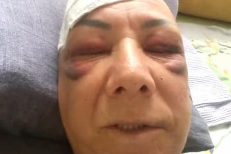 Kavınvalidesini yaralayan sanığa 8 yıl hapis cezası