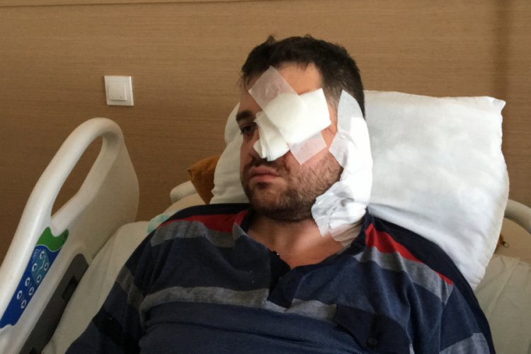 Avukatı kör eden saldırgan, boşanma davasındaki müvekkilin kocası çıktı