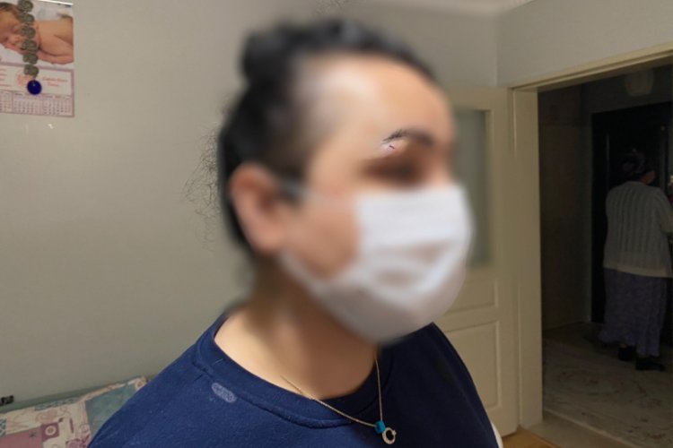 Site sakininin güvenlik görevlisine saldırı anları kamerada