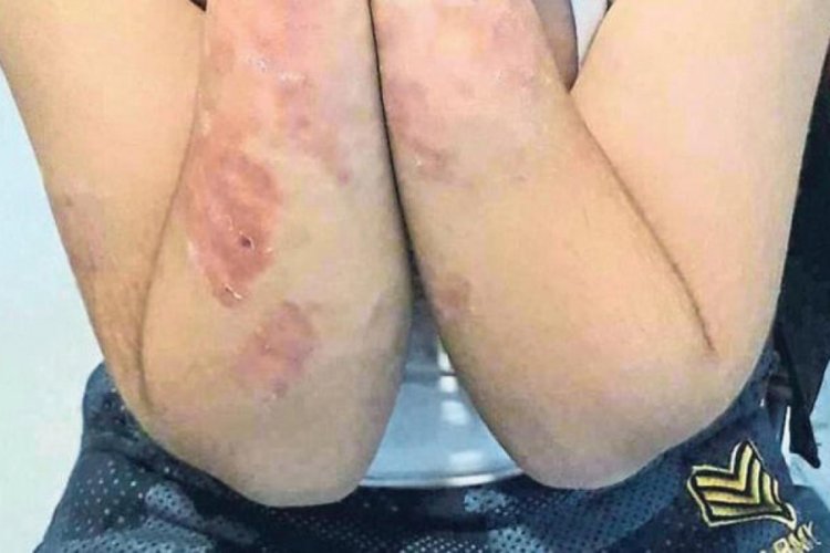 Engelli annesinin zaferi: Sesimi duyurabildim