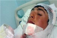 Ölü taklidi yaparak kurtuldu