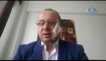 Bursa'da icra takibi yapan avukatın ısırarak yanağını kopardı!