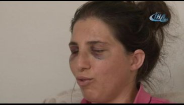 'Neden çocuğun ağzı silinmedi?' dedikten sonra bu hale getirdi!