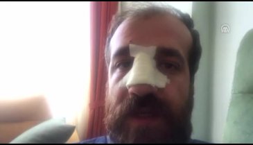 Doktor ve öğretmene sağlık merkezinde darp!