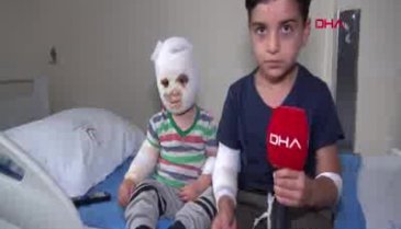 Ocaktaki çaydanlık 2 kardeşin üzerine devrildi