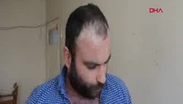 Hastalığı nedeniyle vücudu pullanan Murat, eve kapandı