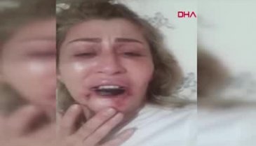 Güzellik uğruna hayatı karardı (+18)