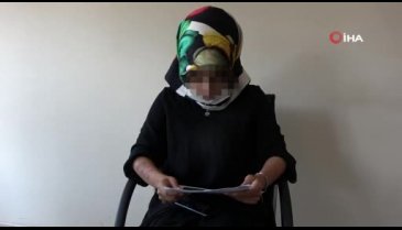 Lazer epilasyon genç kadının vücudunu yaktı