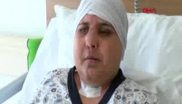 Bursalı kadının yüzü kazada ikiye ayrıldı