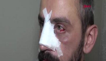 Bursa'da saldırıya uğrayan muhabir: Bizler gazeteciyiz