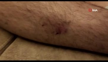 Bursa'da köpeklerin saldırısına uğradı