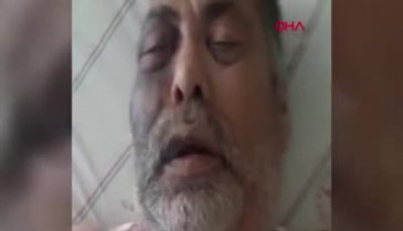 Engelli adam ile ailesini dövüp, şişeye oturtmakla tehdit ettiler