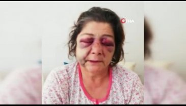 Belediye başkanının adamları tarafından dövüldü, başkan 'düşmüştür' dedi!