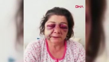 'Park' tartışmasında oğlu ve gelini ile birlikte darbedildi