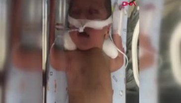 Doğum sırasında düşürüldüğü iddia edilen Azra bebek, savaş veriyor