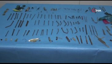 Midesinden çıkanlara doktorlar bile inanamadı