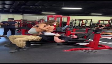 Bradley Martyn şov yapayım derken yüzünü parçaladı
