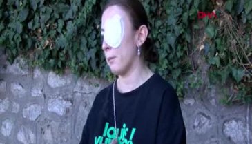 Bursa'da eski erkek arkadaşı tarafından acımasızca darp edildi!