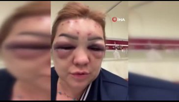 Talihsiz kadın tanınmayacak hale geldi!