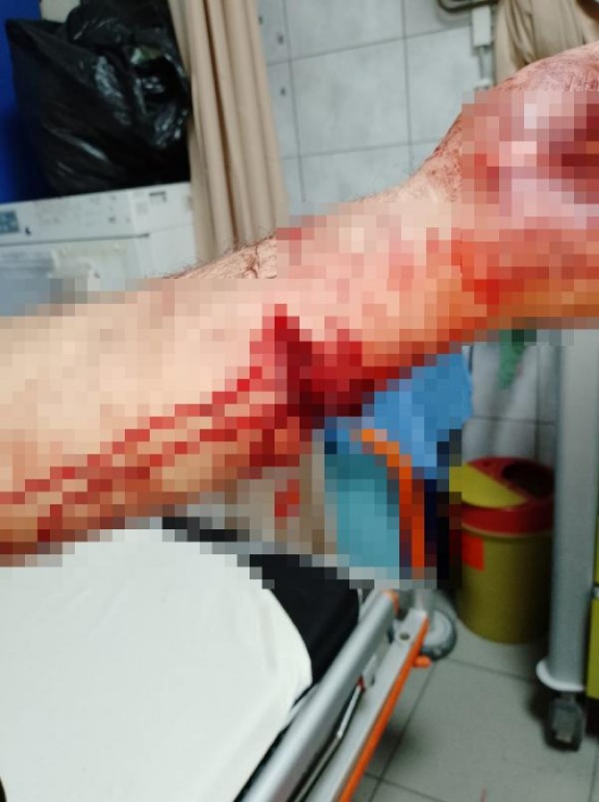 Bursa'da pitbull ile saldırı davasında çarpıcı ifade: Bizde köpeğe dokunmak günah