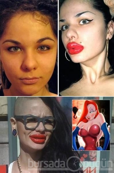 Estetik faciaları!