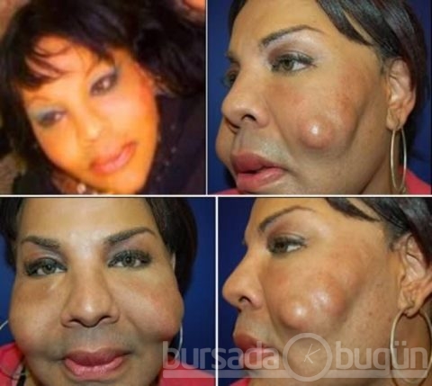 Estetik faciaları!