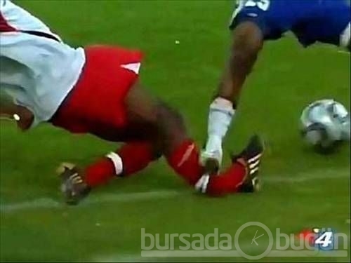 Kolu bacağı kırılan futbolcular
