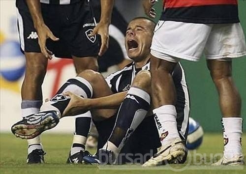 Kolu bacağı kırılan futbolcular