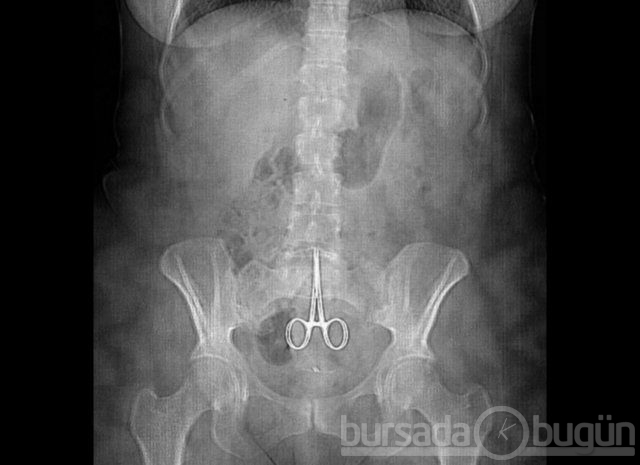 Akılalmaz X-Ray görüntüleri!
