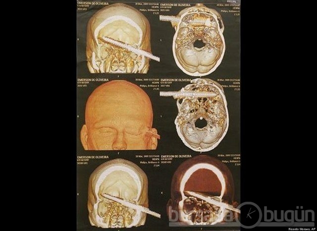 Akılalmaz X-Ray görüntüleri!