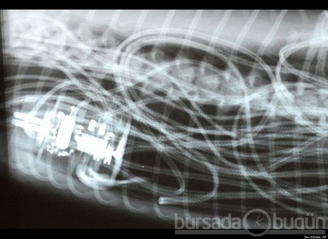 Akılalmaz X-Ray görüntüleri!