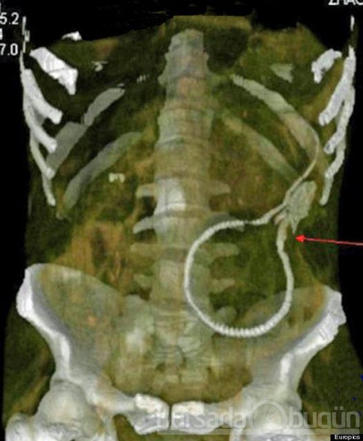 Akılalmaz X-Ray görüntüleri!