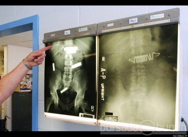 Akılalmaz X-Ray görüntüleri!