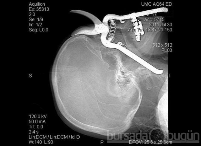 Akılalmaz X-Ray görüntüleri!