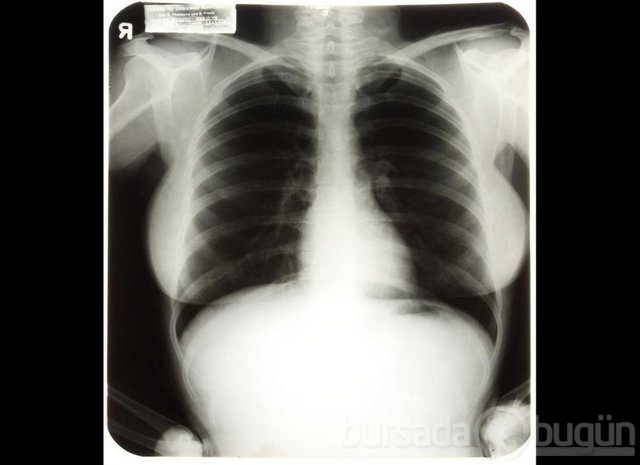 Akılalmaz X-Ray görüntüleri!