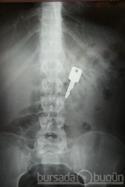 Akılalmaz X-Ray görüntüleri!