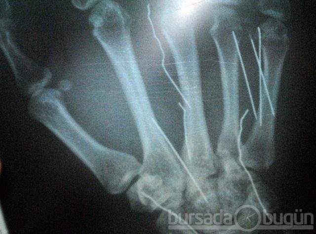 Akılalmaz X-Ray görüntüleri!