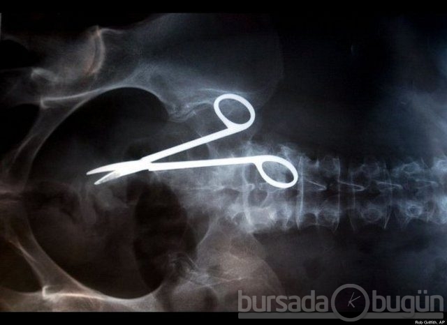 Akılalmaz X-Ray görüntüleri!