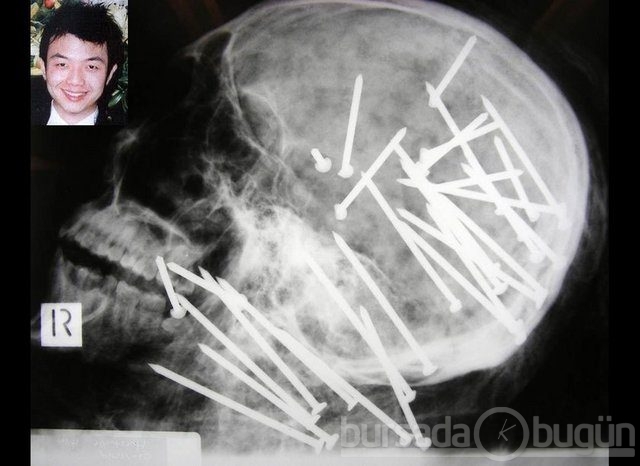 Akılalmaz X-Ray görüntüleri!